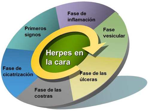 Fases del herpes en la cara - como quitar un herpes en la cara rapido